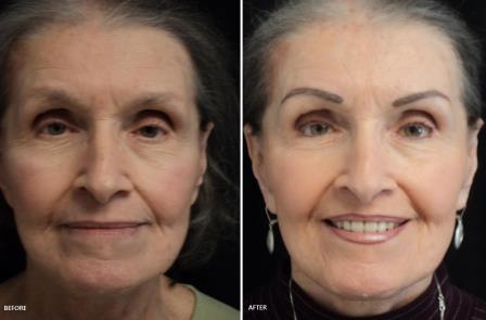 перманентный макияж или татуаж фото до и после