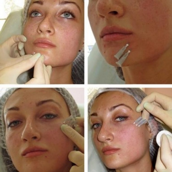 Салонные процедуры для подтяжки кожи лица